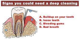 Newhall Dentist Improves Gum Health With A Deep Cleaning