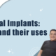 dental-implants-types-and-their-uses