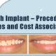 teeth-implant-procedure-types-and-cost-associated