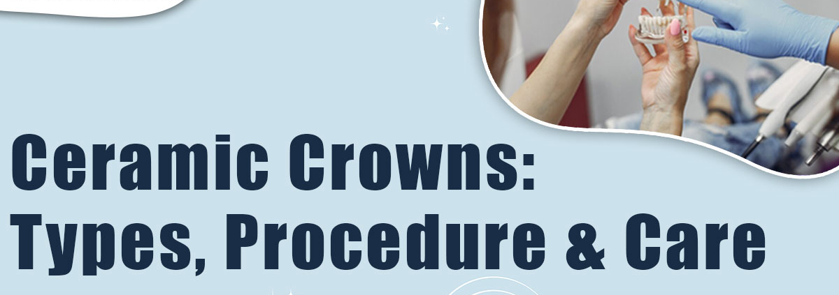 ceramic-crowns-types-procedure-&-care