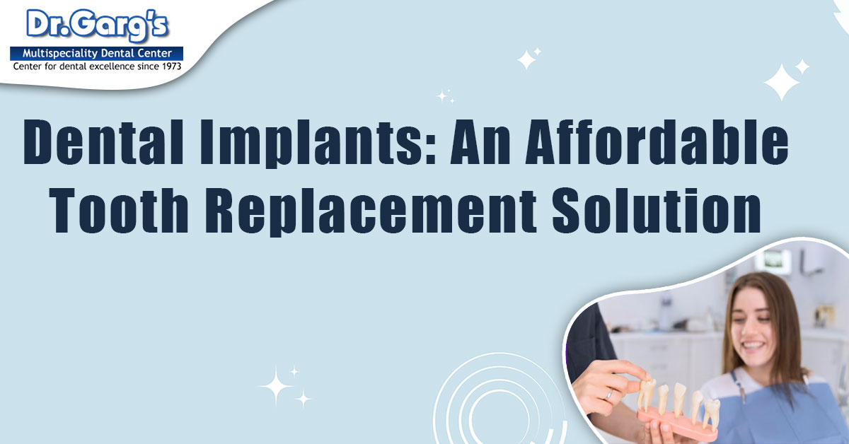 Dental Implants An Affordable Tooth Replacement Solution