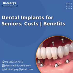 Dental Implants for Seniors: Costs, Benefits, Procedure