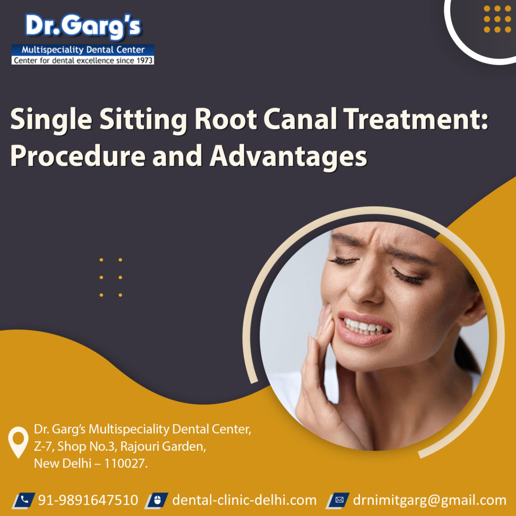 Single Sitting Root Canal Treatment: Procedure and Advantages: Root Canal Treatment
