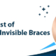 cost of Invisalign or Invisible Braces so high