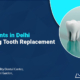 dental implants in delhi