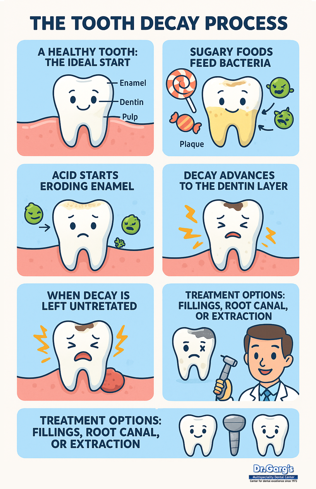 Tooth Decay Process