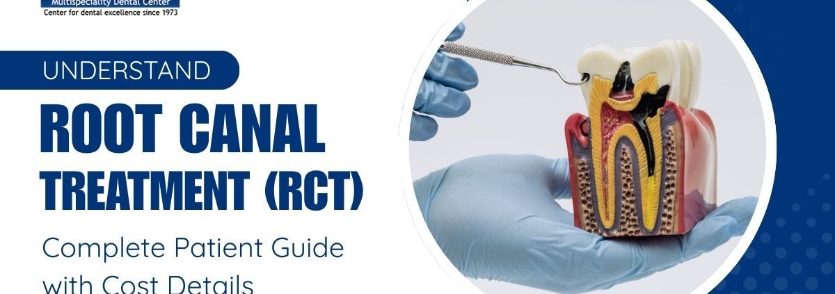 Root Canal Treatment (RCT): A Complete Patient Guide with Cost Details