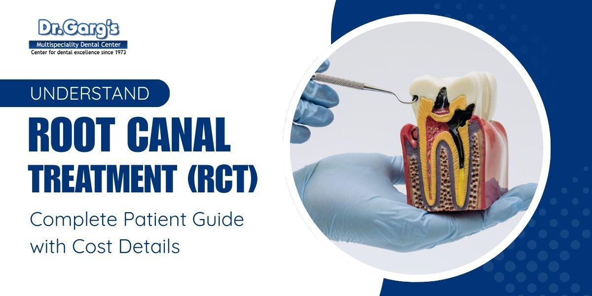 Pamphlet For Rct Root Canal Treatment (RCT): Complete Patient Guide with Cost