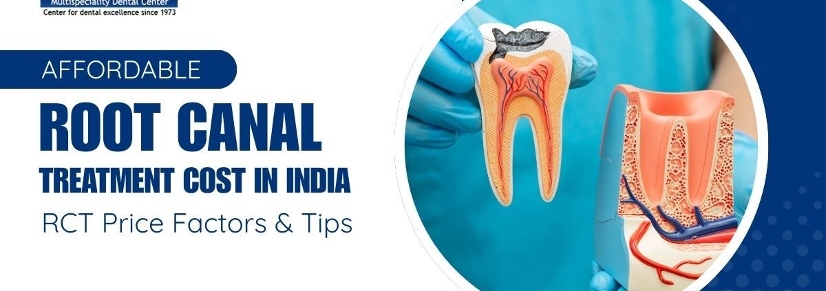 Complete Guide to the Sinus Lift Procedure: Indications, Steps & Healing Time