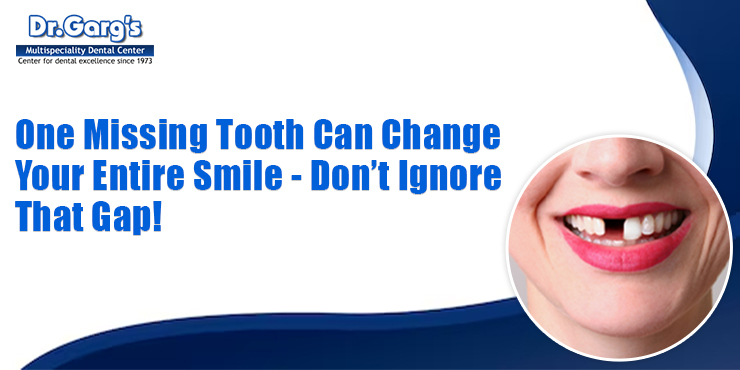 one missing tooth can change your entire smile - don’t ignore that gap!