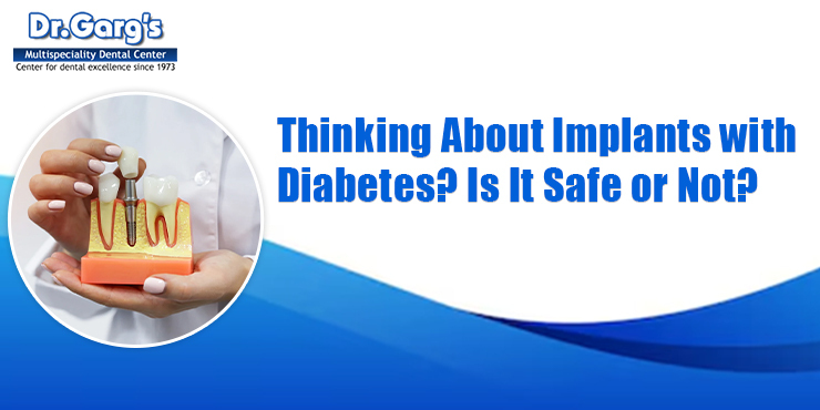 Dentist holding dental implant model demonstrating tooth replacement while highlighting safety of dental implants for patients with diabetes.